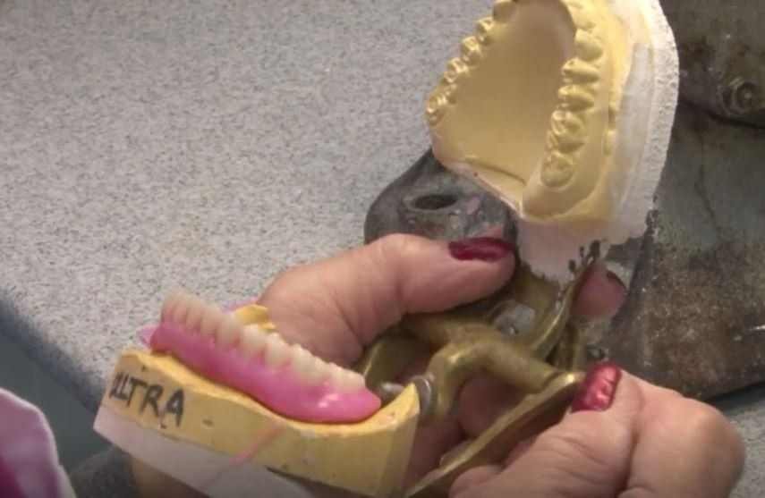 Denture Education Program Module 21 All On Four (4)